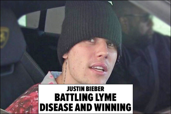 Justin Bieber reveals he is battling Lyme disease