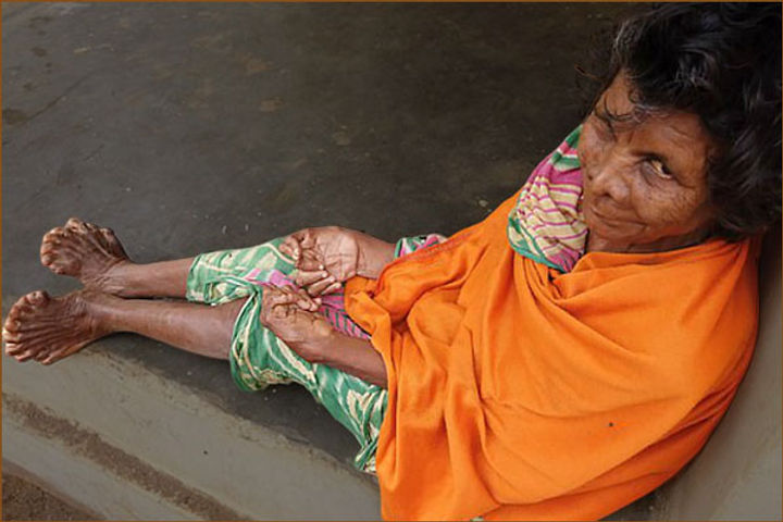 woman born with 20 toes and 12 fingers branded a witch and forced to stay indoors