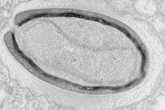 Giant virus discovered with features only seen in living cells