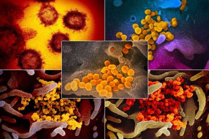 Microscopic images of deadly Coronavirus revealed 