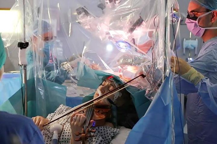 A brain surgery patient and a musician plays violin while doctors remove her tumour
