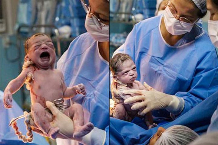 Newborn girl seen in anger while cutting umbilical cord, pictures viral