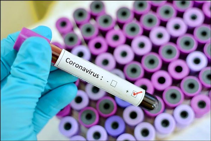 Coronavirus could survive up to 9 days outside the body says study 