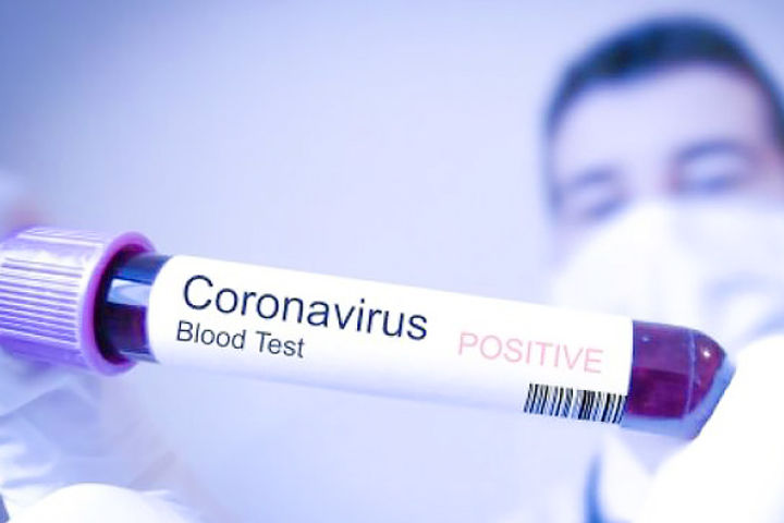 Mumbai man who tested positive for coronavirus took a train to attend a wedding contacted 1000 peopl