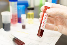 IIT Delhi Researchers Develop Cheapest Corona Test Kit