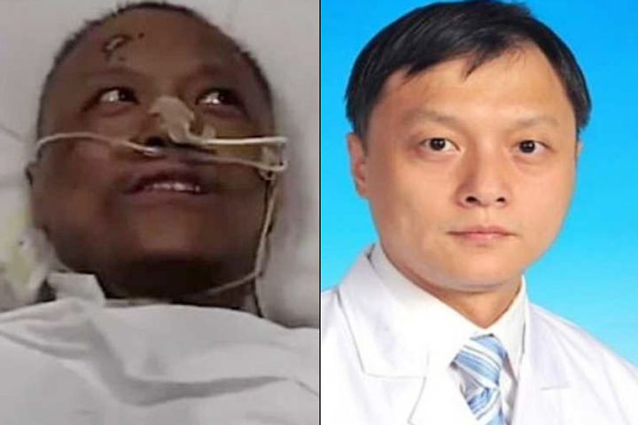 Coronavirus has darkened the skin, damaged the liver of Wuhan doctors who got infected Coronavirus has darkened the skin, damaged the liver of Wuhan doctors who got infected