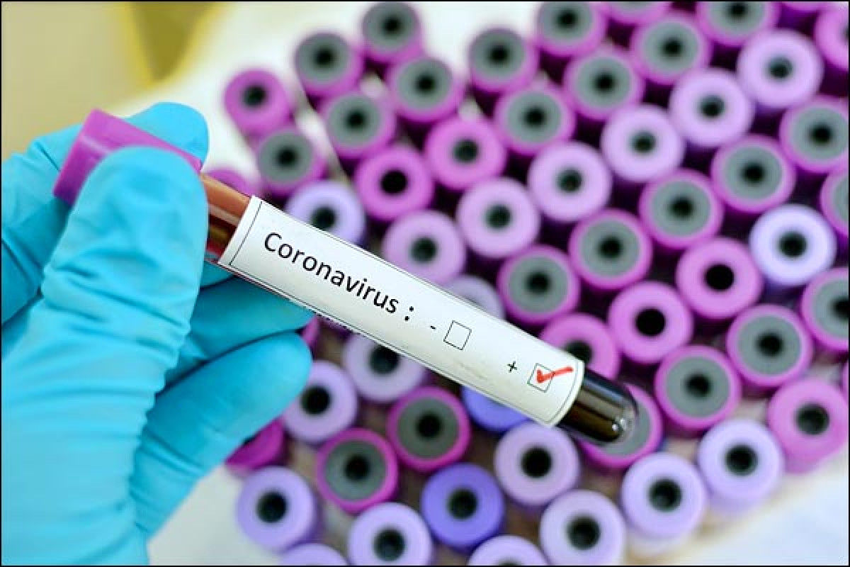 Coronavirus reporter goes missing