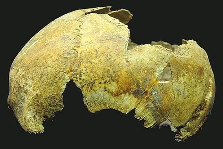 5000 year old skull