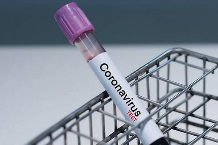 Coronavirus Coronavirus
