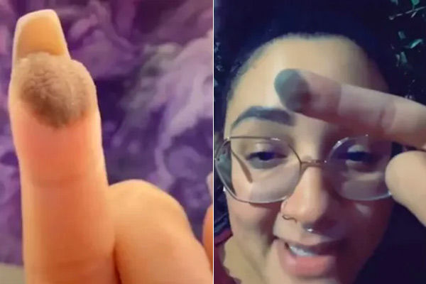Pubic hair growing out of woman's finger