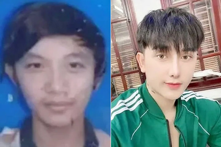 Vietnamese man undergoes plastic surgery after he was laughed at over ...