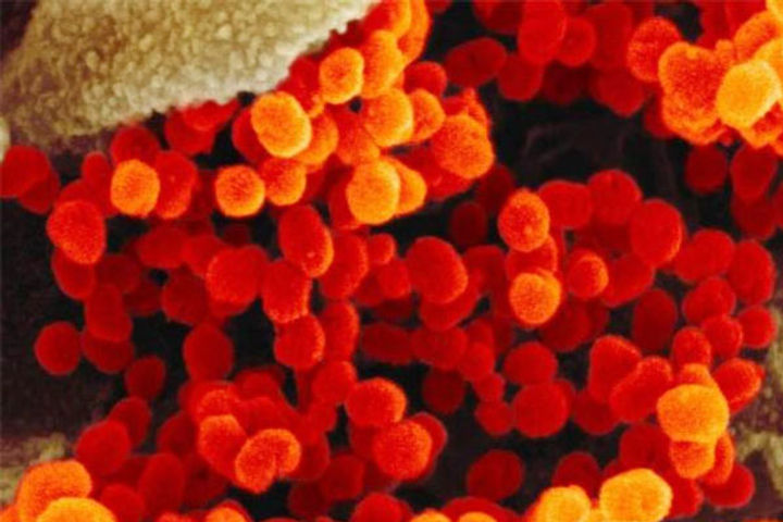 Coronavirus Pandemic Coronavirus Pandemic