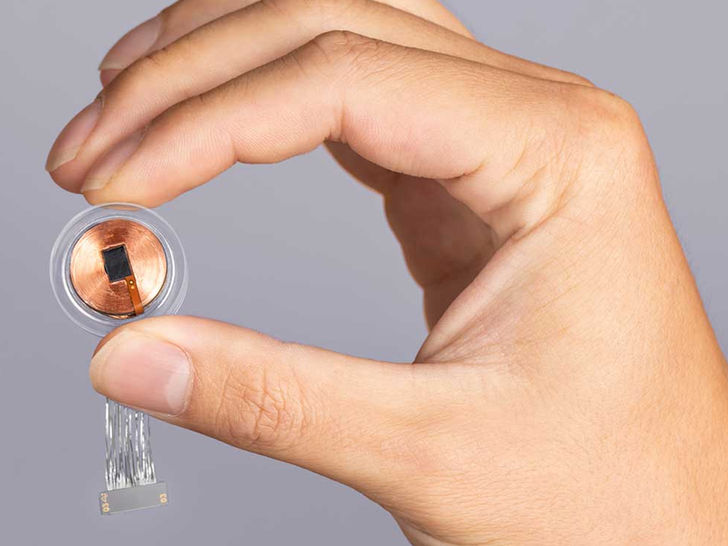 The Neuralink Chip Gives Us Much to Think About The Neuralink Chip Gives Us Much to Think About