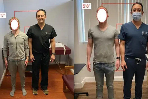 Doctor claims he can make people taller 