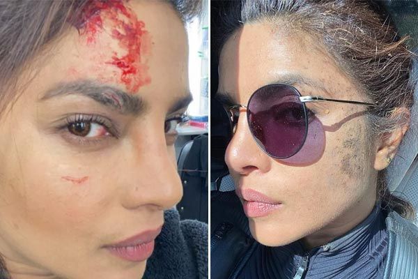 priyanka chopra injured on the sets of citadel shares pics