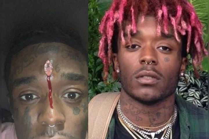 US Rapper Lil Uzi Vert Got A Diamond Worth 174 Crores Installed On The Forehead, The Fans Uprooted I US Rapper Lil Uzi Vert Got A Diamond Worth 174 Crores Installed On The Forehead, The Fans Uprooted I