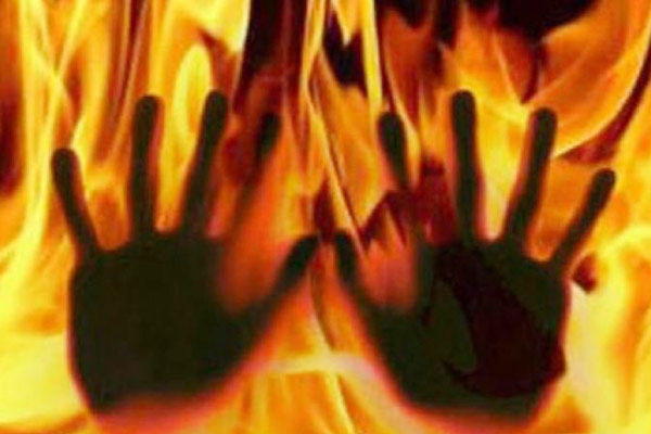 fire broke out after two dumpers collided driver burnt alive three scorched in kanpur