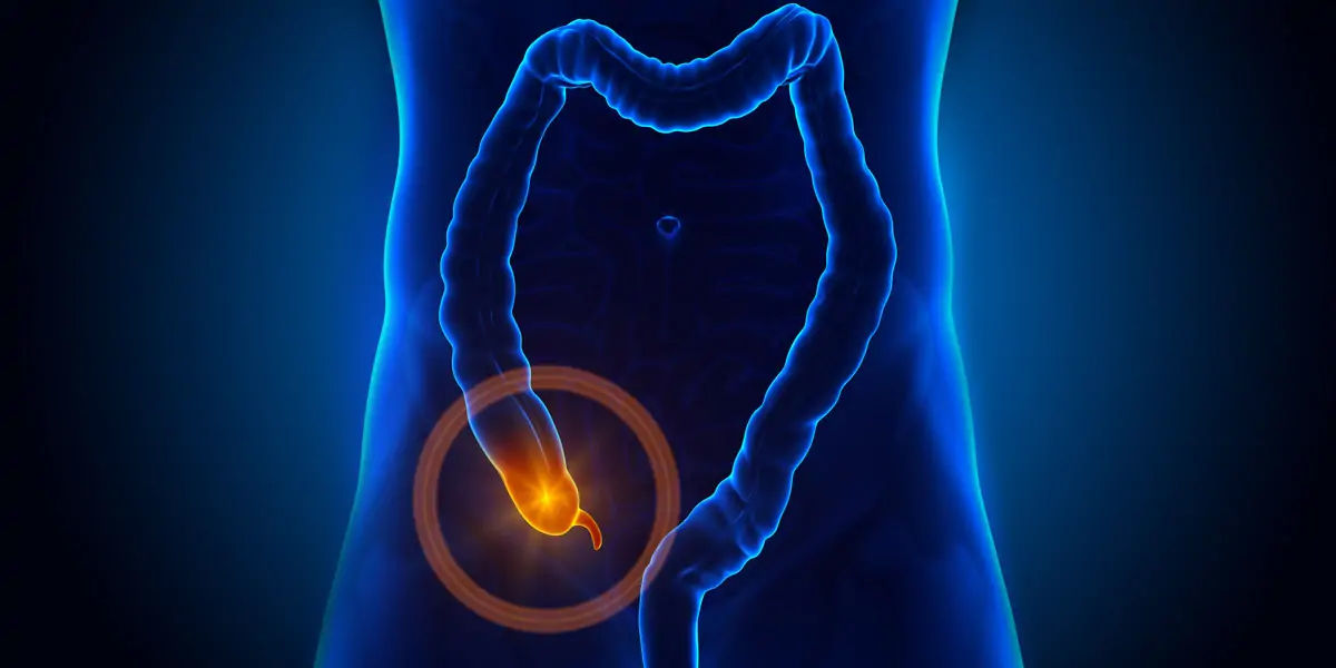 fun fact, appendix, appendix operation, appendix fact