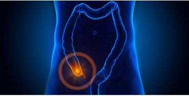 fun fact, appendix, appendix operation, appendix fact 