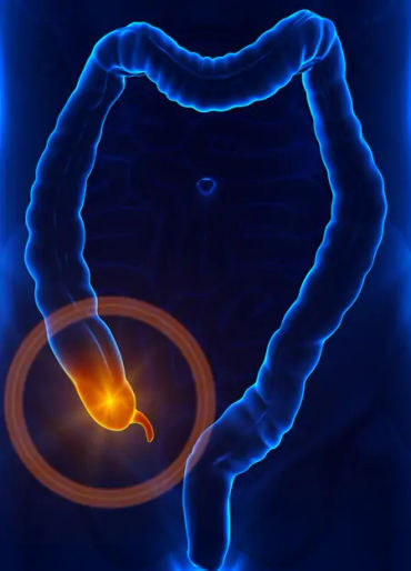 fun fact, appendix, appendix operation, appendix fact 