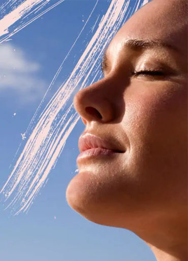 sun exposure, acne, acne break