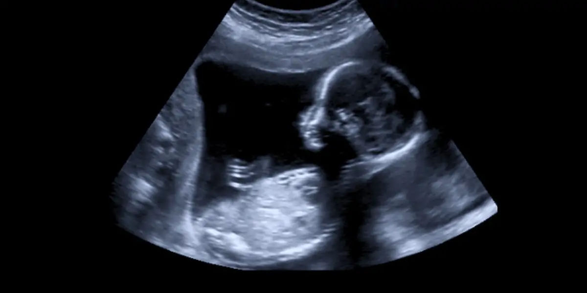 boys facts, facts about boys, facts about men, men facts, baby facts, male baby facts, baby boy fact