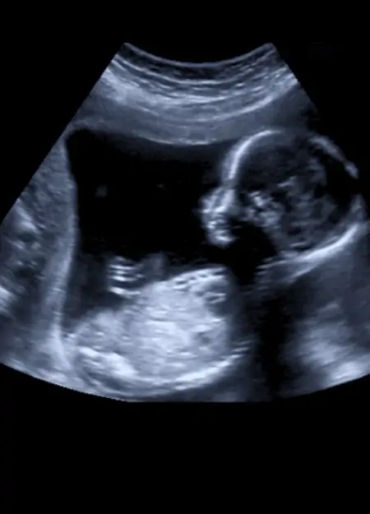 boys facts, facts about boys, facts about men, men facts, baby facts, male baby facts, baby boy fact