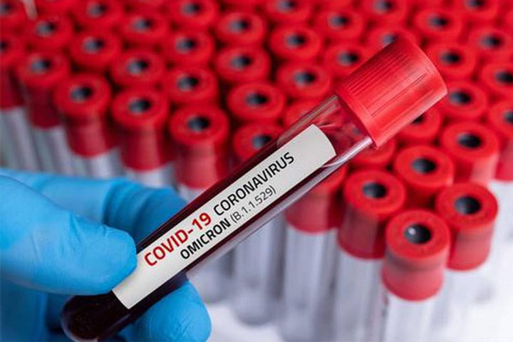 Coronavirus Pandemic