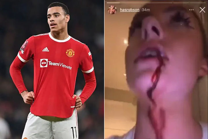 Girlfriend accused Mason Greenwood of forcibly having sex and beating her