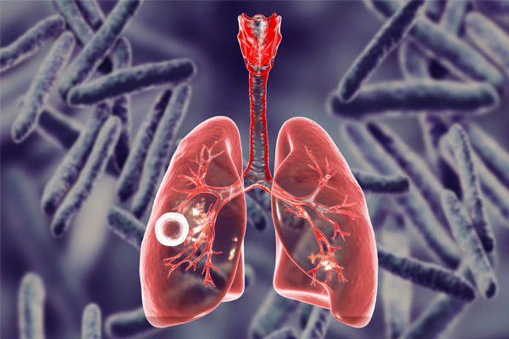 The bacteria responsible for TB were discovered on this day Robert Koch got the Nobel Prize