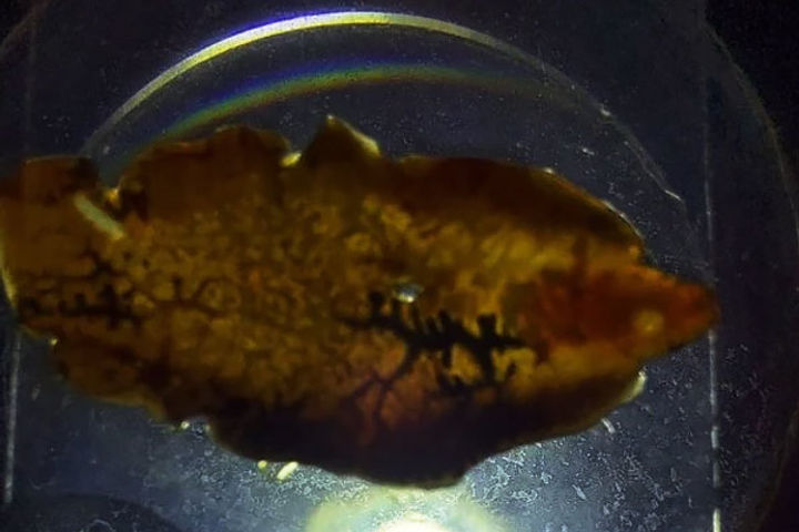 Strange worm found in place of stone during gall bladder operation doctors surprised