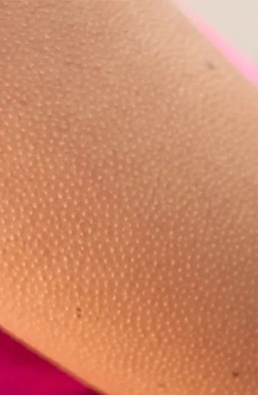 goosebumps, stories, terrifying, forefathers, muscles, hair, skin, emotional