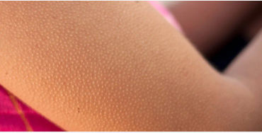 goosebumps, stories, terrifying, forefathers, muscles, hair, skin, emotional
