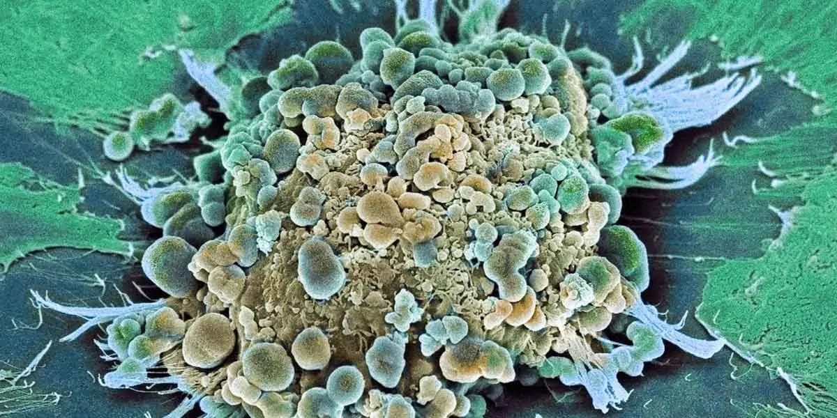 cell, cancer, infected, selfdestruct, apoptosis, growth, regulate, body, mitotic
