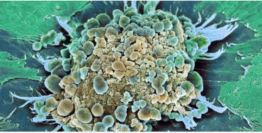 cell, cancer, infected, selfdestruct, apoptosis, growth, regulate, body, mitotic