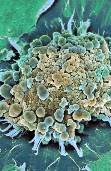 cell, cancer, infected, selfdestruct, apoptosis, growth, regulate, body, mitotic