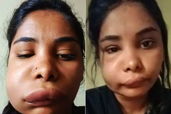 actress swati satishs face deteriorated after root canal surgery