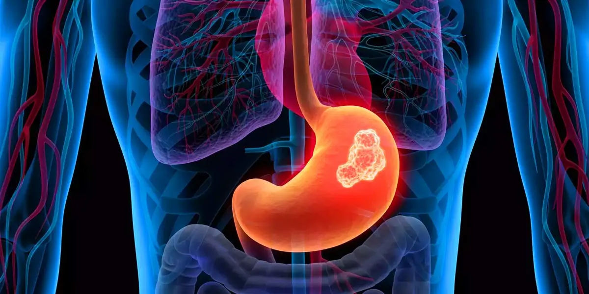 gut health, how to improve gut health, gut healthy foods, gut health supplements, best foods for gut