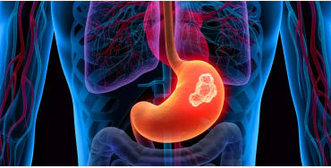 gut health, how to improve gut health, gut healthy foods, gut health supplements, best foods for gut