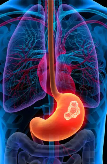gut health, how to improve gut health, gut healthy foods, gut health supplements, best foods for gut