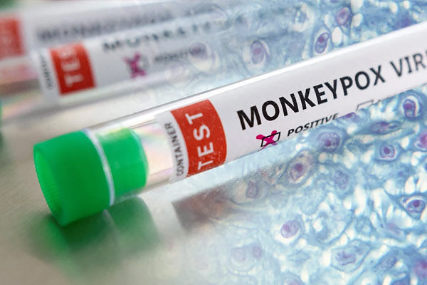 patient of monkeypox