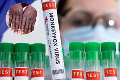 monkeypox suspect found in solan