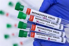 Fourth case of monkeypox in Delhi, Nigerian woman infected Now 9 cases in the country