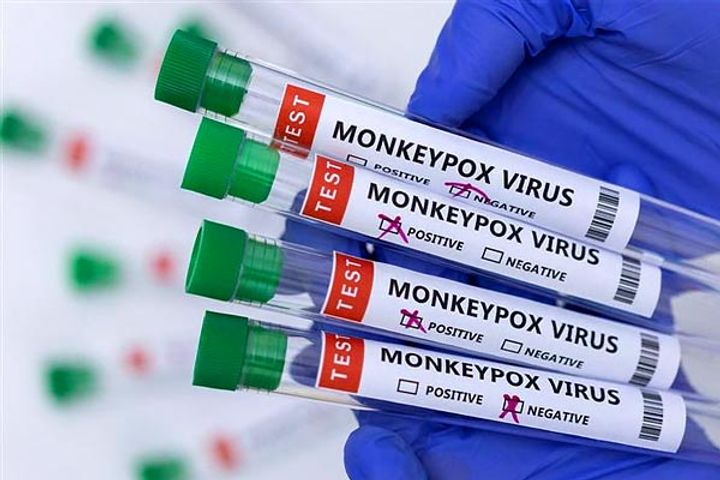 Fourth case of monkeypox in Delhi, Nigerian woman infected Now 9 cases in the country