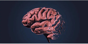 Alzheimer's disease 