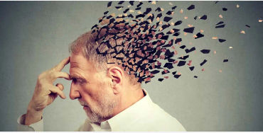 alzheimer's
