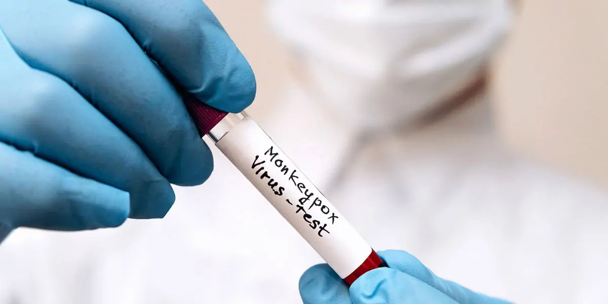 monkeypox, disease, africa, infected, cases