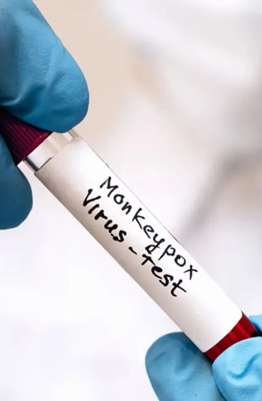 monkeypox, disease, africa, infected, cases