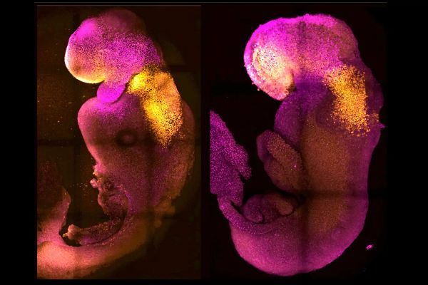 Artificial embryonic brain developed and heart beat for the first time