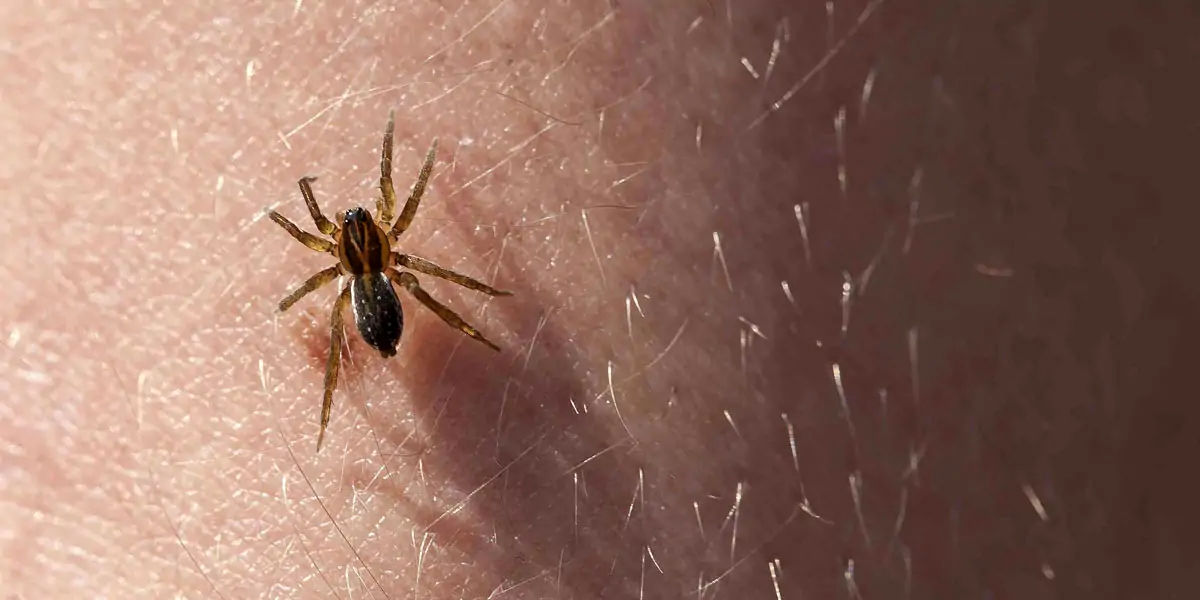 spider bites